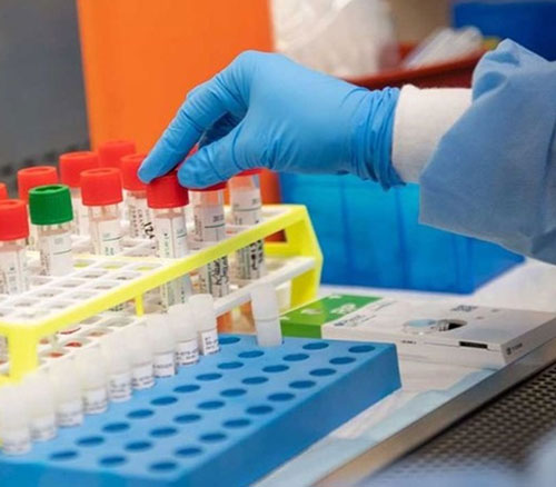 Saudi Arabia, China Sign Contract for 9 Million Coronavirus Tests